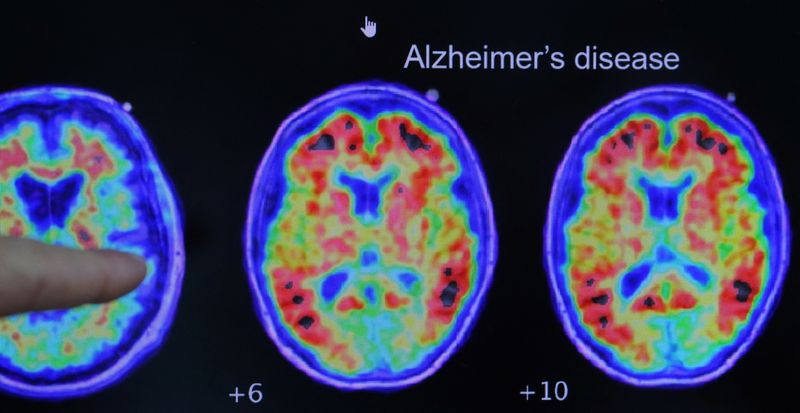 Cassava Sciences must face malicious prosecution lawsuit over Alzheimer’s drug